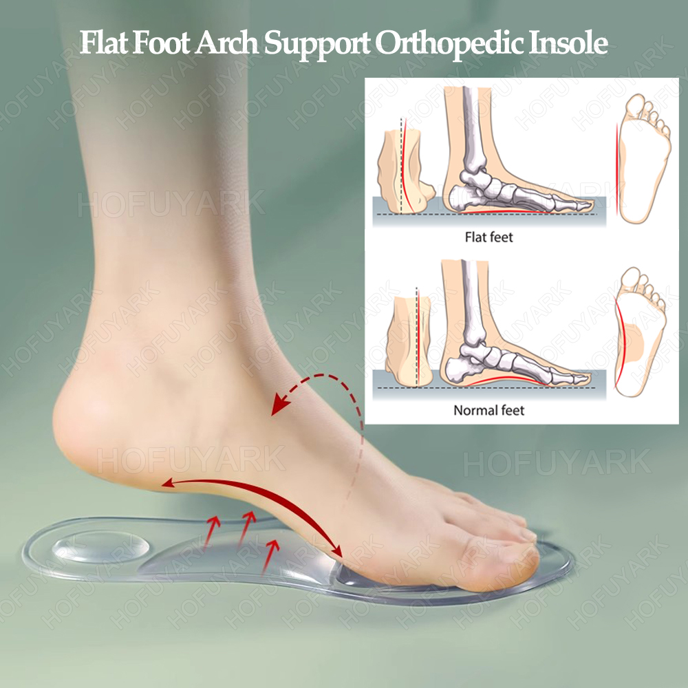 Siliconen Gel Inlegzolen Ortho - Women'S Shoes High Arch Support recensie en prijs